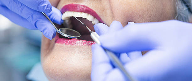 Best Urgent Care for Lost Fillings or Crowns in Averill Park, NY